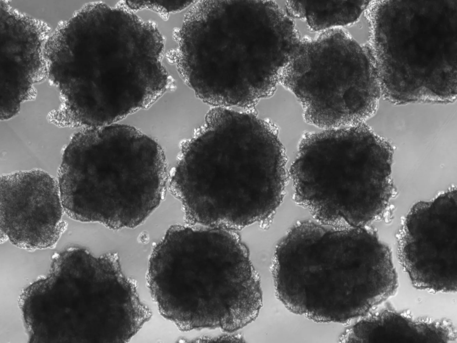 Χρησιμοποιώντας οργανοειδή ανθρώπινου εγκεφάλου (μινιατούρα, εργαστηριακά αναπτυγμένα μοντέλα εγκεφάλου), η ομάδα συνέκρινε τις επιδράσεις του μολύβδου σε δύο εκδοχές ενός βασικού αναπτυξιακού γονιδίου που ονομάζεται NOVA1, ένα γονίδιο που είναι γνωστό ότι ενορχηστρώνει την έκφραση γονιδίων κατά την έκθεση σε μόλυβδο κατά τη νευροανάπτυξη. Η σύγχρονη ανθρώπινη εκδοχή του NOVA1 είναι διαφορετική από αυτή που βρέθηκε στους Νεάντερταλ και άλλα εξαφανισμένα ανθρωποειδή. Πίστωση: Πανεπιστήμιο της Καλιφόρνια Σαν Ντιέγκο