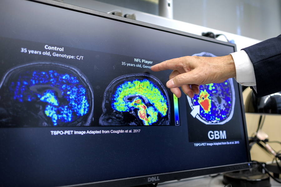 Σοκαριστική Ανακάλυψη: 1 στους 5 Ασθενείς με Καρδιακή Ανεπάρκεια Κρύβει Άνοια πριν τα 65! Ανακαλύψτε πώς η Έγκαιρη Διάγνωση Μπορεί να Σώσει Ζωές!