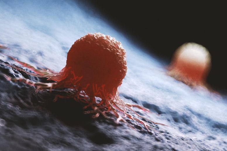 Σχετικά με νέα έρευνα αποκαλύπτει ότι ο καρκίνος του παχέος εντέρου εκτοξεύεται σε ενήλικες κάτω των 50 ετών