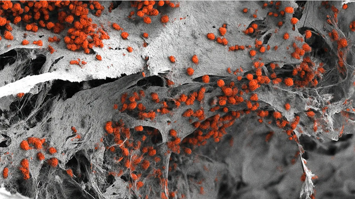 Το νέο εργαστηριακό μοντέλο μυελού των οστών είναι μια πρώτη βιομηχανική