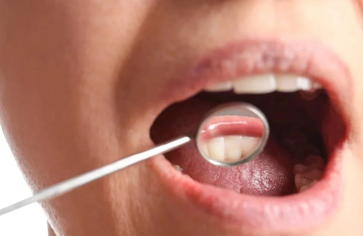 «Προειδοποιητικά Σημάδια Καρκίνου του Στόματος: Μάθε τις Αιτίες, τη Διάγνωση και γιατί η Πρόληψη είναι Ζωτικής Σημασίας!»