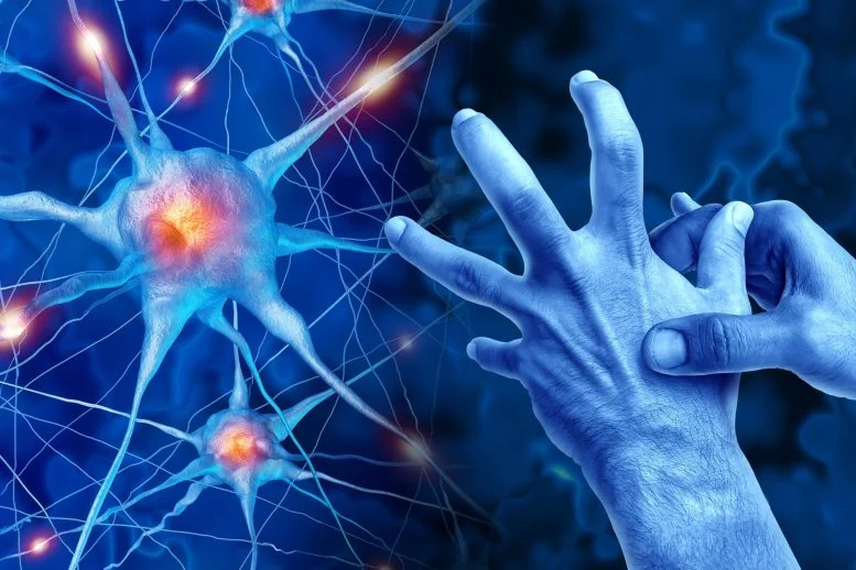 Οι επιστήμονες λένε ότι μια σημαντική υπόθεση για τη νόσο του Πάρκινσον μπορεί να είναι λανθασμένη