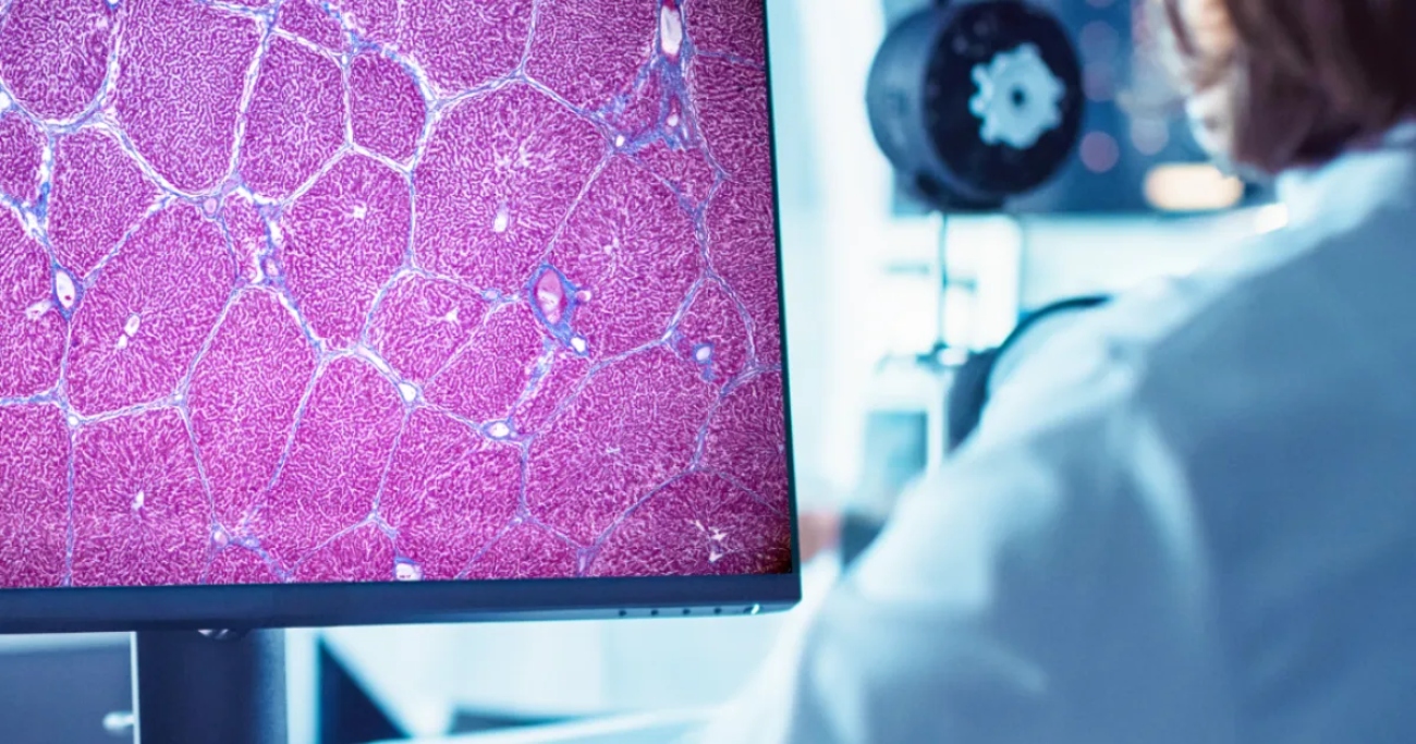 ΕΠΑΝΑΣΤΑΤΙΚΗ ΕΞΕΛΙΞΗ: Εγκρίθηκε το ΠΡΩΤΟ εργαλείο τεχνητής νοημοσύνης που θα αλλάξει τα δεδομένα στις κλινικές δοκιμές φαρμάκων για ηπατική νόσο!