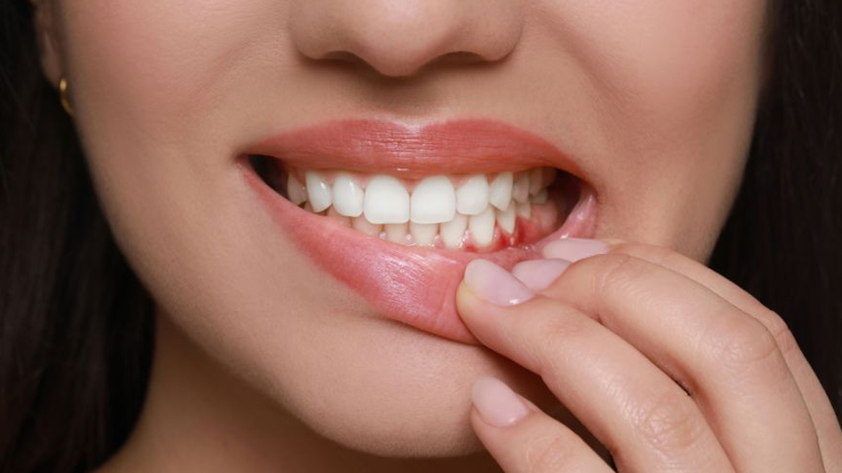 «Προσοχή! Η ουλίτιδα μπορεί να κρύβει σοβαρούς κινδύνους για την καρδιά σας!»