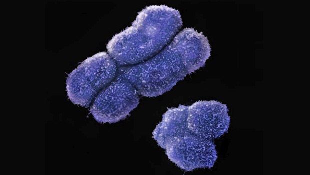 «Ανατρεπτικές Μεταλλάξεις: Το Γενετικό Μωσαϊκό του Σώματός μας! Δείτε Πώς!»