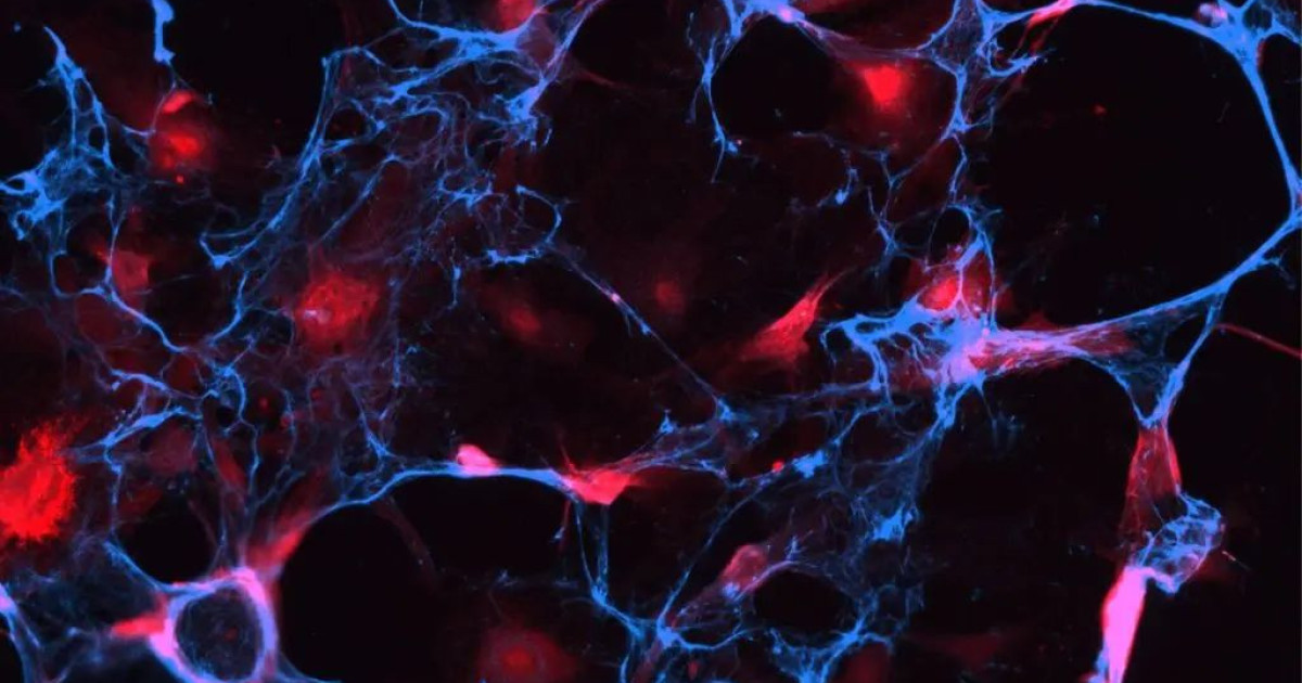 «Η «τρελή» ιδέα φοιτητών που μπορεί να επαναστατήσει στη γήρανση – Μάθε πώς!»