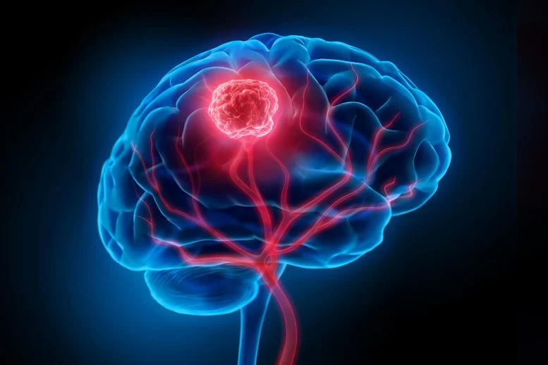 Θα μπορούσε μια απλή ρινική σταγόνα να αντιμετωπίσει τον πιο θανατηφόρο καρκίνο του εγκεφάλου;