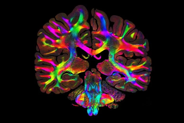 Οι επιστήμονες αποκαλύπτουν κρυμμένα δίκτυα ινών μέσα σε ανθρώπινους ιστούς