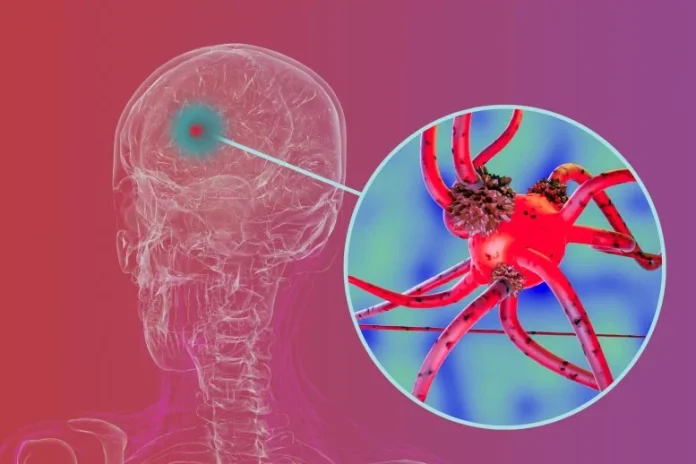 Το ευρέως χρησιμοποιούμενο Farm Chemical μπορεί να υπερδιπλασιάσει τον κίνδυνο για τη νόσο του Πάρκινσον