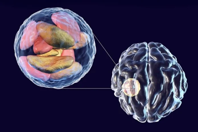 Αυτό το κοινό παράσιτο του εγκεφάλου μπορεί να μολύνει τα κύτταρα του ανοσοποιητικού που προορίζονται να το σκοτώσουν