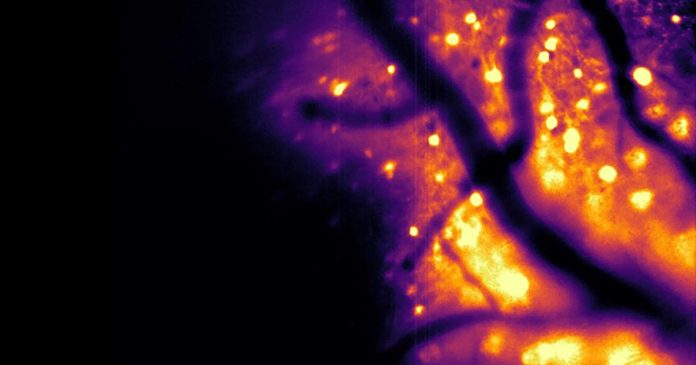 Νευρώνες που λάμπουν μόνοι τους ανοίγουν νέους δρόμους στη χαρτογράφηση του εγκεφάλου