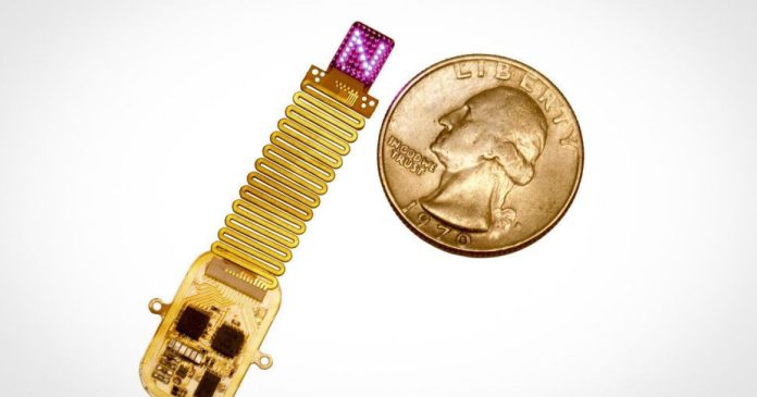 Το νέο ασύρματο τσιπ που στέλνει δεδομένα απευθείας στον εγκέφαλο
