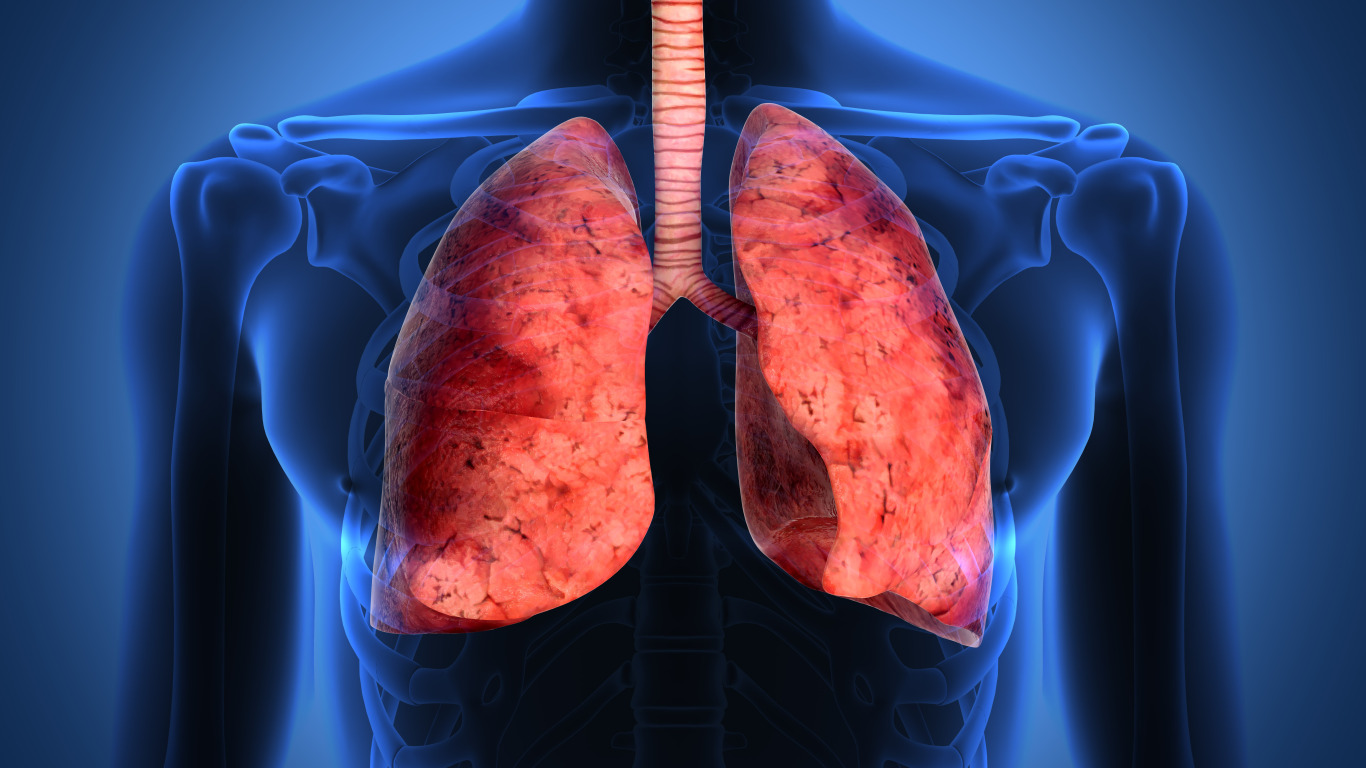 «Ανακαλύψτε το Επαναστατικό ‘Πνεύμονα-σε-τσιπ’: Η Τεχνολογία που Σηματοδοτεί τη Νέα Εποχή στην Αναπνοή!»