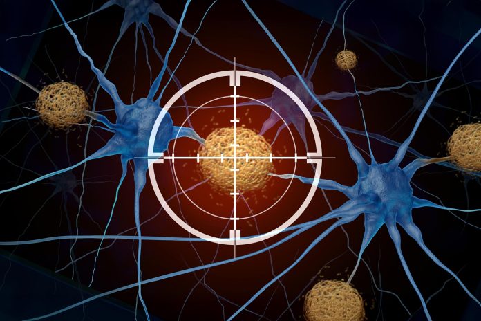 Η σημαντική ανασκόπηση διαπιστώνει ότι τα αμυλοειδή φάρμακα για το Alzheimer δεν προσφέρουν κανένα πραγματικό όφελος