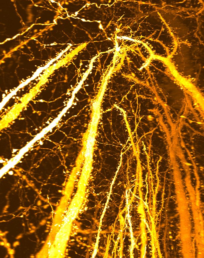 Νέα Προκλήσεις Ανακάλυψης Εγκεφάλου Η μακροχρόνια θεωρία της ανάπτυξης του εγκεφάλου των εφήβων