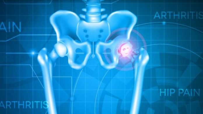 Επώδυνο ισχίο στην παιδική ηλικία: Τι πρέπει να ξέρετε